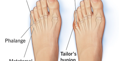 When In Doubt, Pinky Out: How Your Smallest Toe Shapes Balance, Posture, and Performance