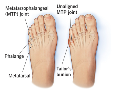 When In Doubt, Pinky Out: How Your Smallest Toe Shapes Balance, Posture, and Performance