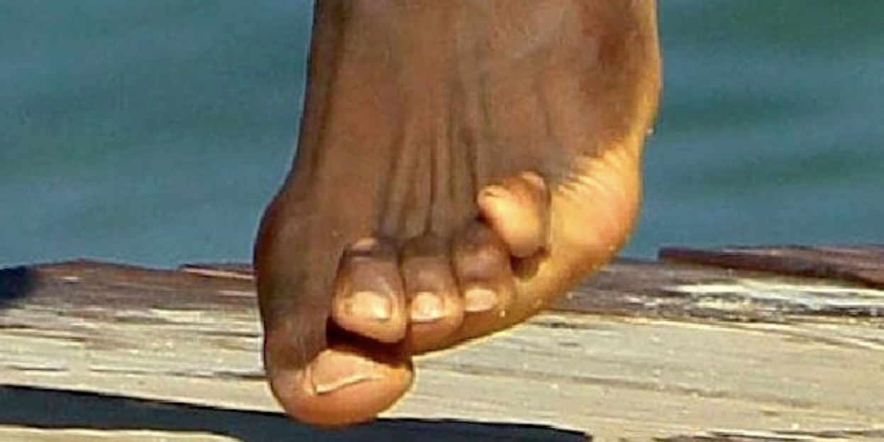 How Shoes Have Deformed Our Feet: A History of Fashion Over Function