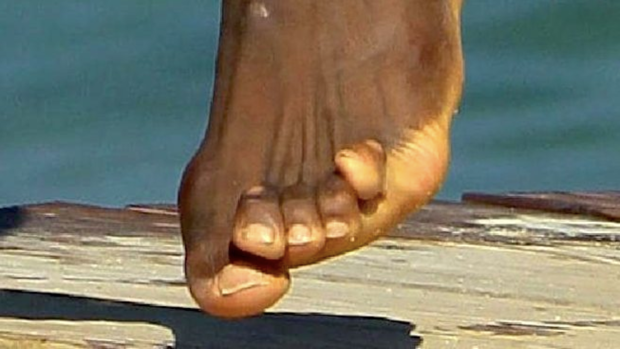 How Shoes Have Deformed Our Feet: A History of Fashion Over Function